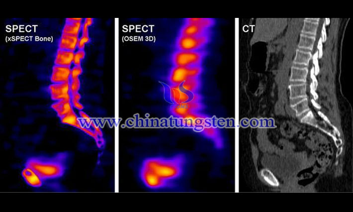 tungsten heavy alloy collimator applied for SPECT picture